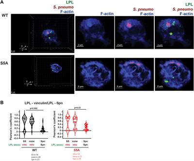 Expression of non-phosphorylatable S5A-L-plastin exerts phenotypes distinct from L-plastin deficiency during podosome formation and phagocytosis